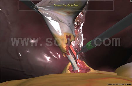膽囊切除術模擬平臺